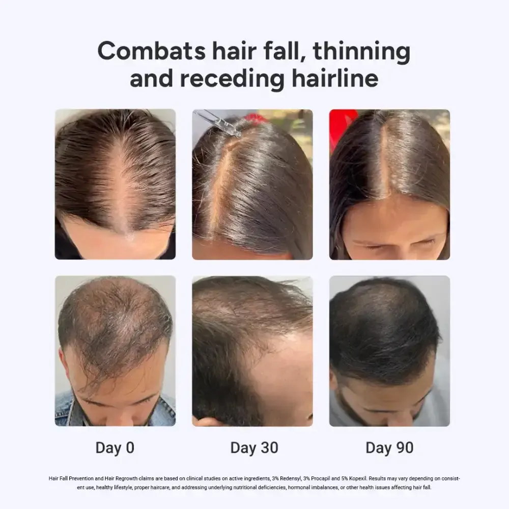 90-Day Value Pack for Fuller, Denser, Thicker Hair Regrowth | Intensive Hair Growth Serum (Pack of 3) - Image 5