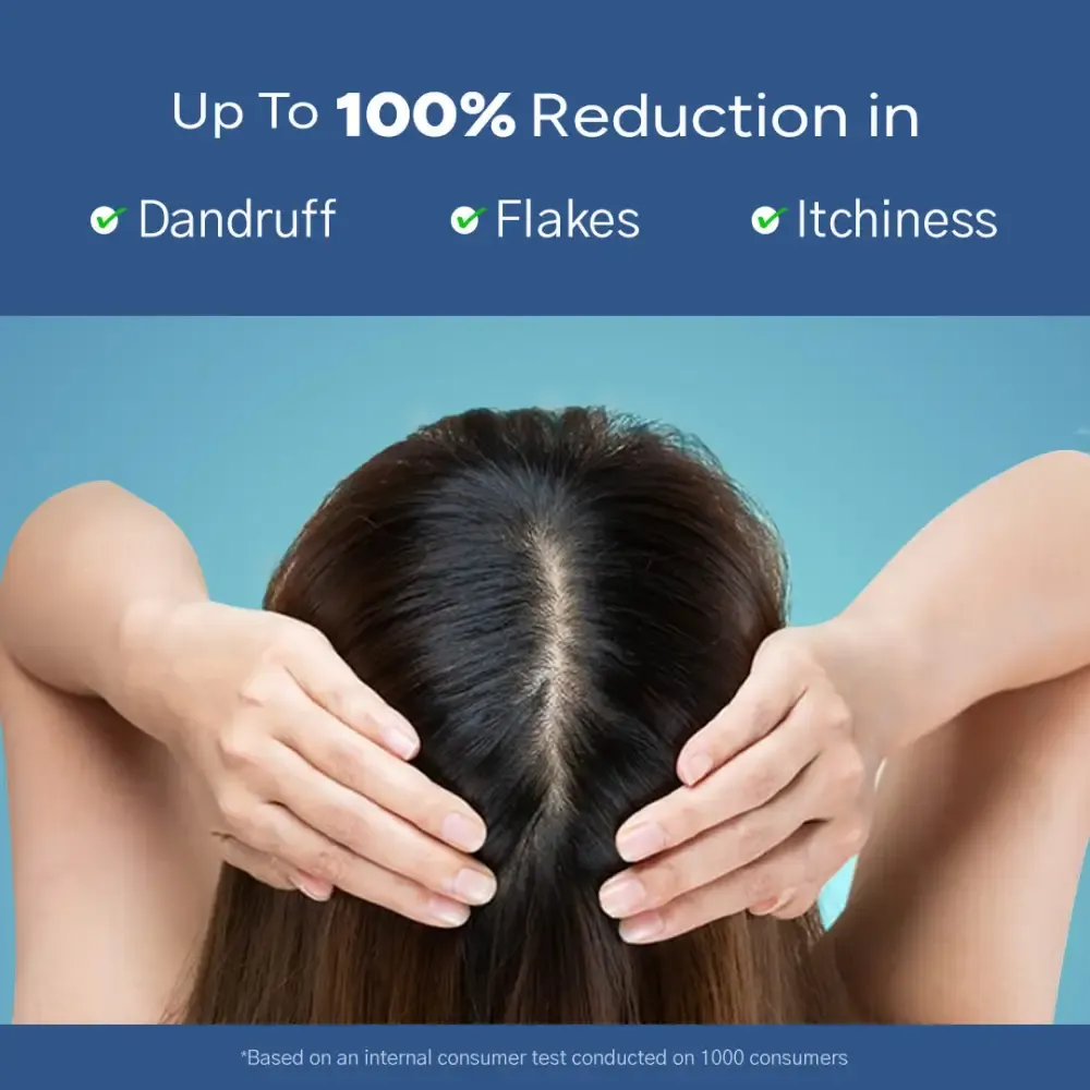 Anti-Dandruff Shampoo (Normal to Oily Hair) BYOB - Image 5